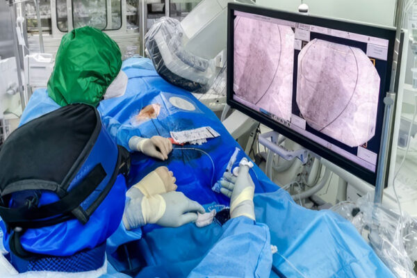 Interventional Radiography Devices Vascular Interventional Radiography